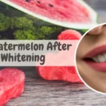 Can I Eat Watermelon After Teeth Whitening