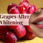 Can I Eat Grapes After Teeth Whitening