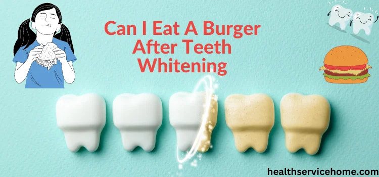 Can I Eat A Burger After Teeth Whitening