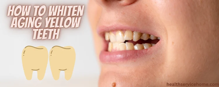 How To Whiten Aging Yellow Teeth