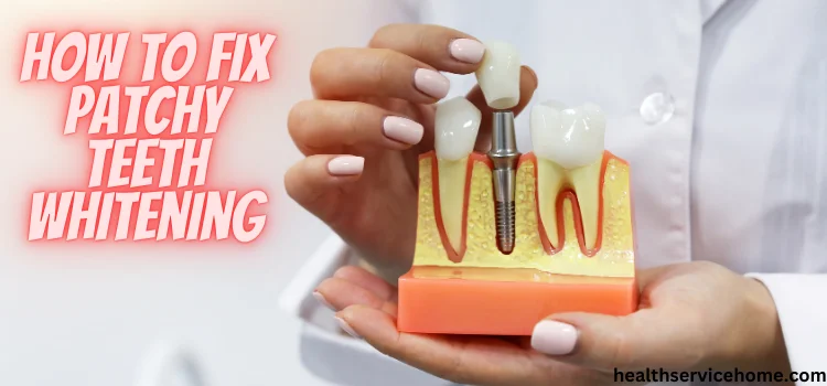 How To Fix Patchy Teeth Whitening