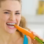 Can You Eat Carrots With Braces